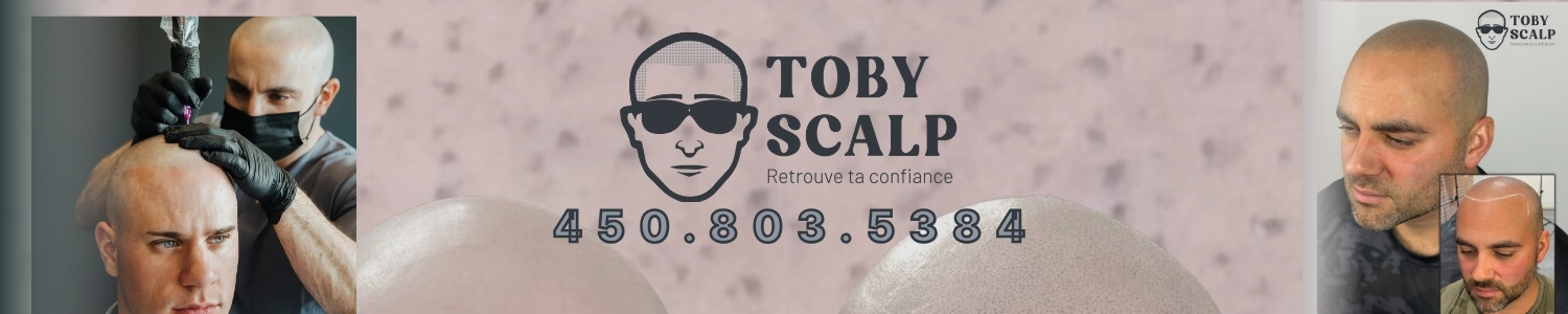 clinique-transplantation-cheveux