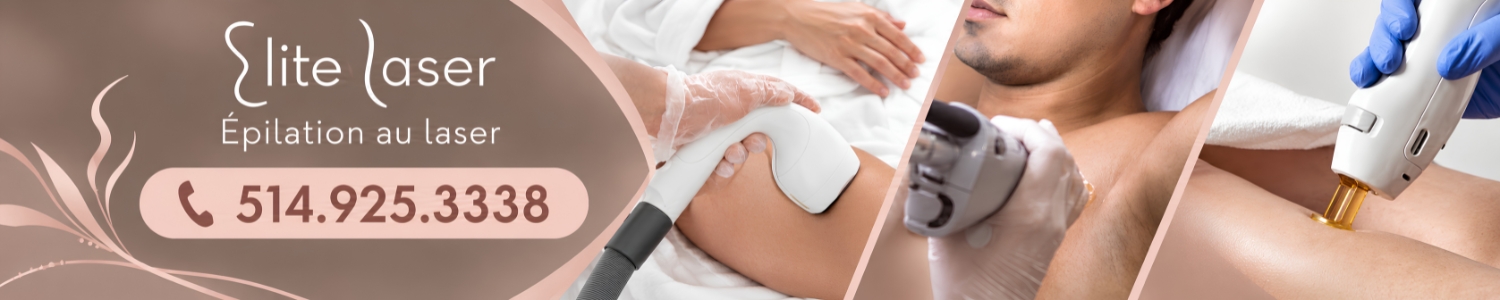 epilation-laser